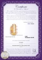 : Y-Alloy-TRP-Clasp-Ohio